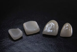 a set of white porcelain teeth on black background