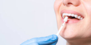 a woman trying out veneers