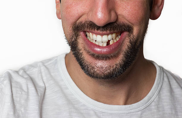a photo showing  a man with a missing tooth