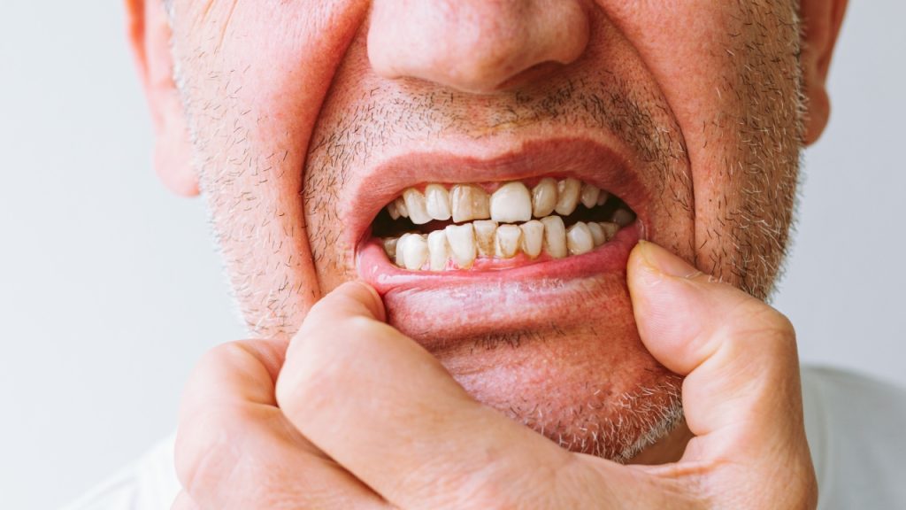 Common Causes of Toothaches