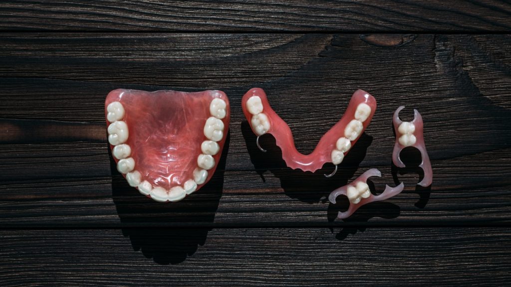 What Are Implant-Supported Dentures