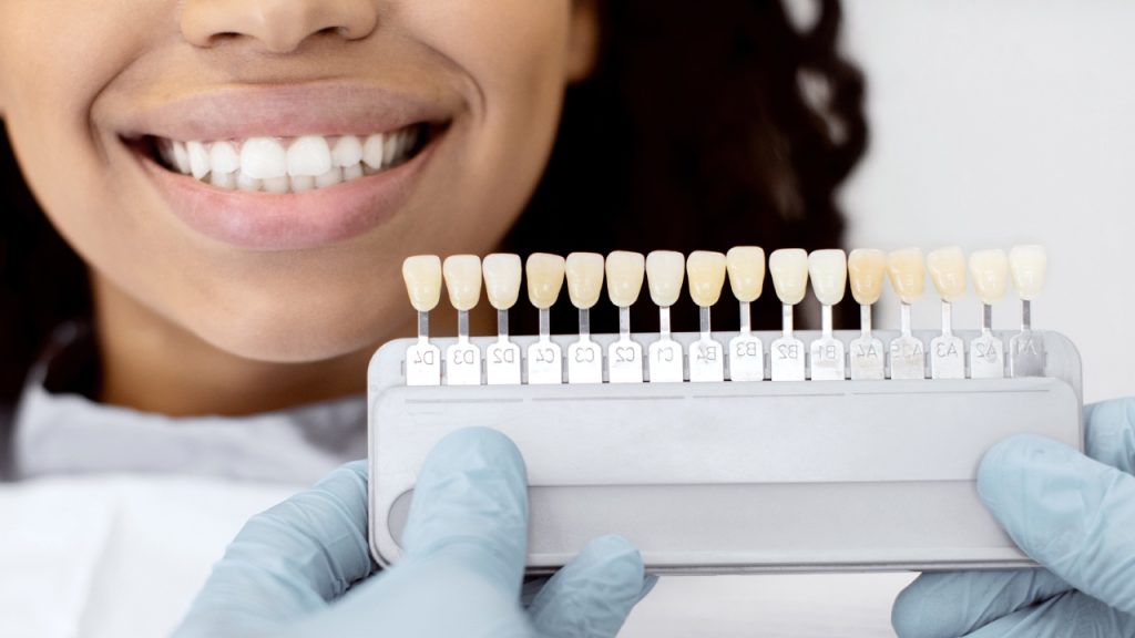 What Are Tooth-Colored Fillings