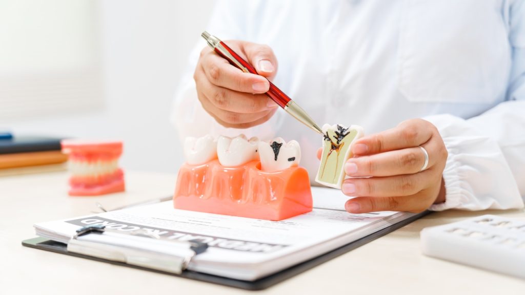 What Is Bone Grafting