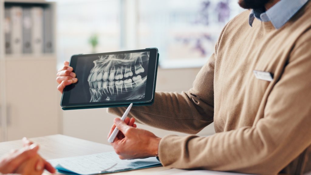 When Are Dental X-Rays Needed