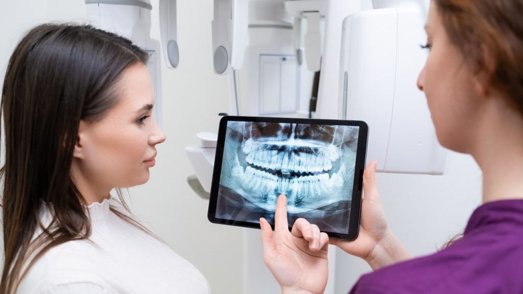 Why Digital X-Rays Matter