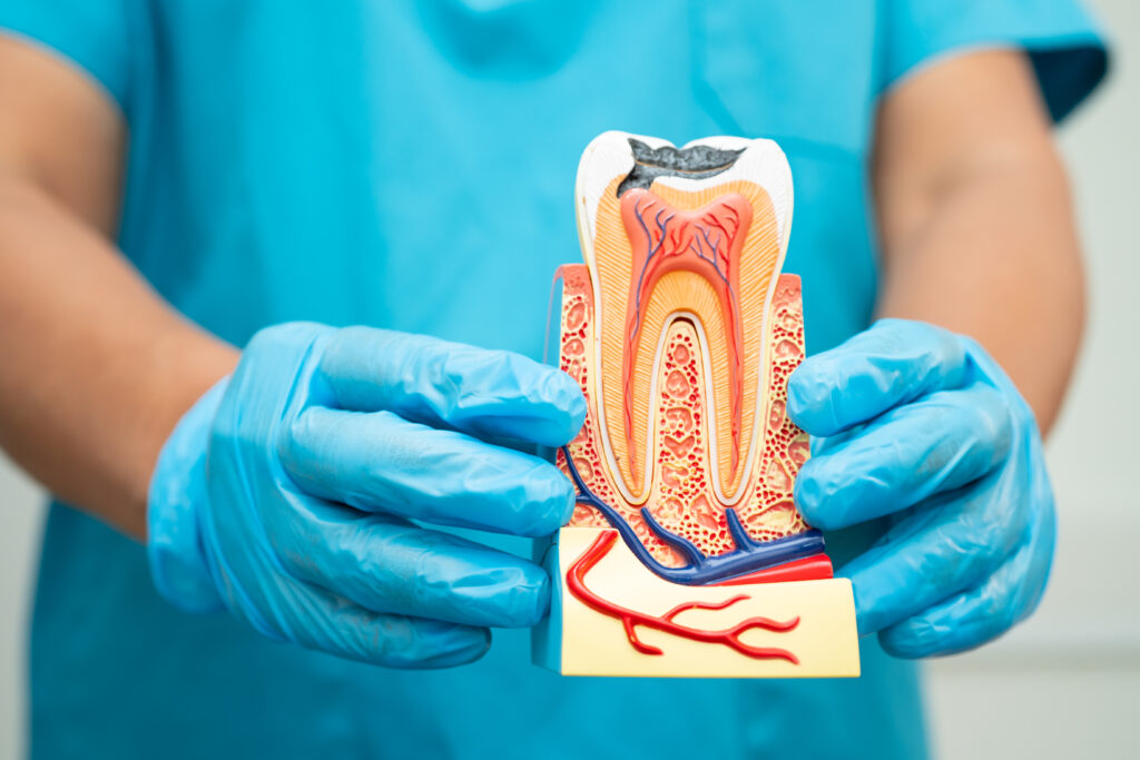 root-canal-therapy