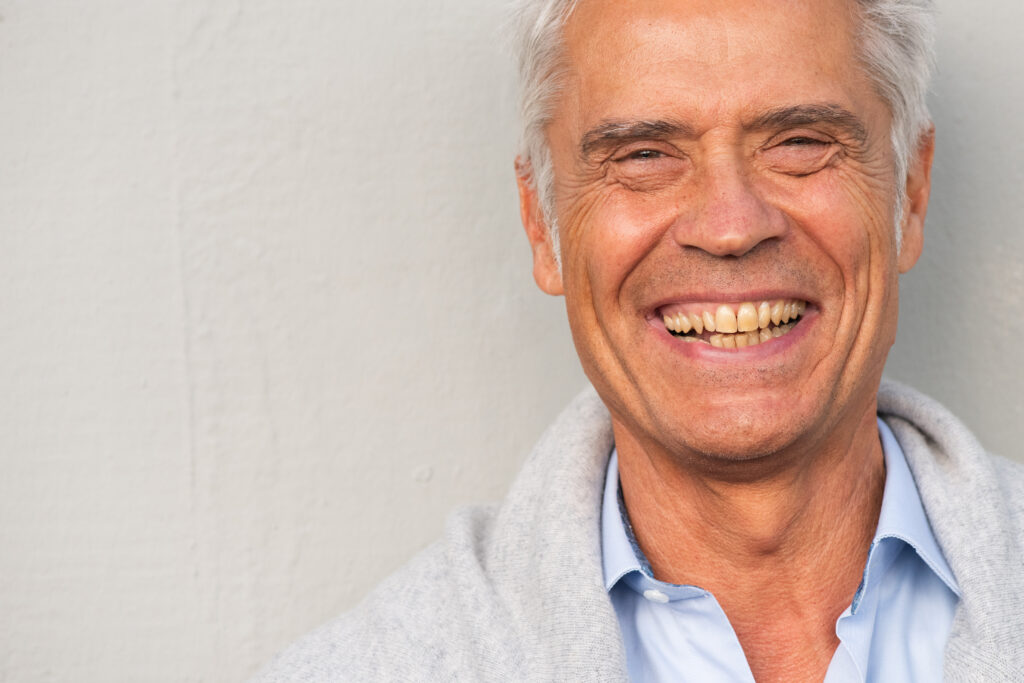 all-on-x-dental-implants