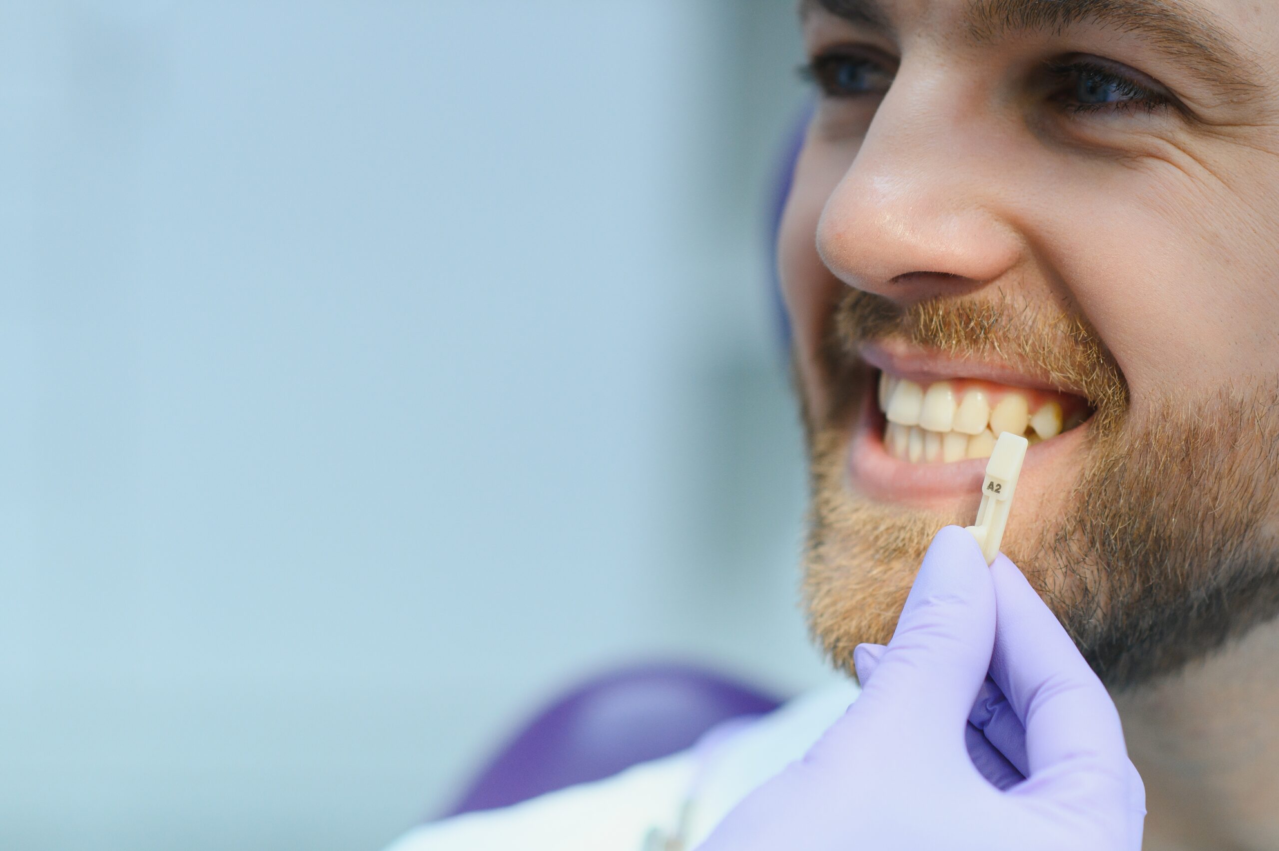 cracked-chipped-tooth-repair