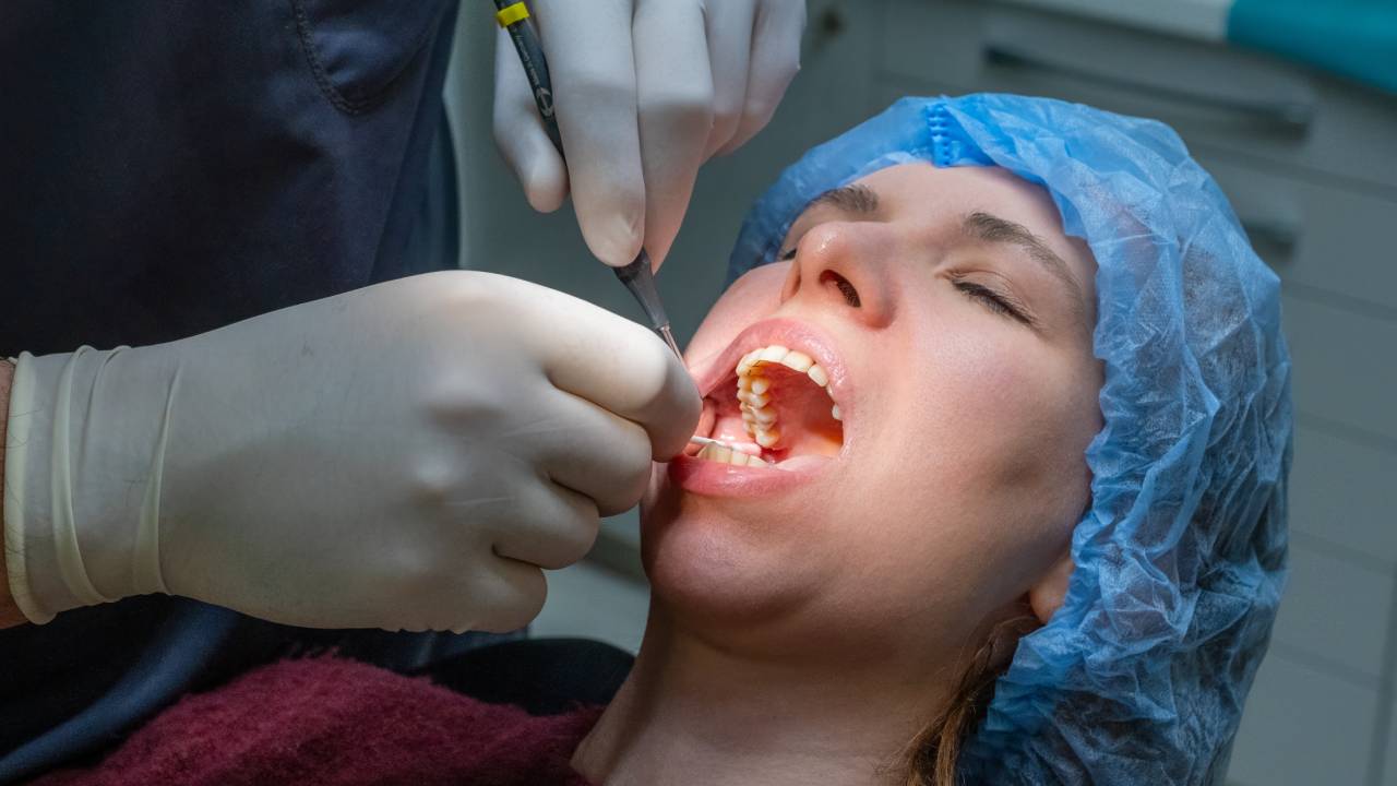 What You Must Know About a Tooth Extraction Emergency